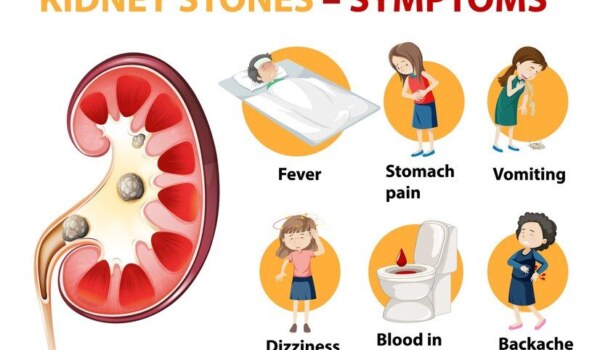 Is kidney stone pain is severe same like baby birth pain?